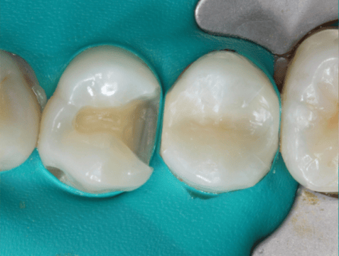 Blog_Halo_Clinical_Guide_DrWright_2-1