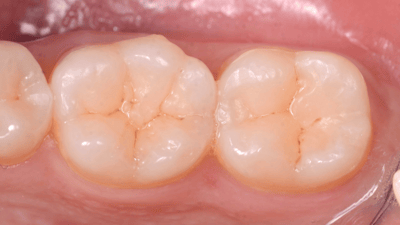 Paolone 8