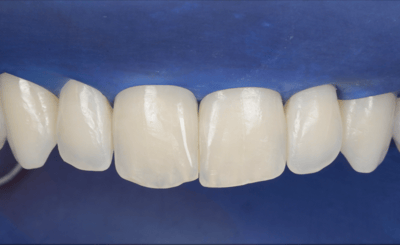 Transcend Mascetti 3