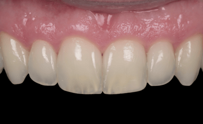Transcend Mascetti 8